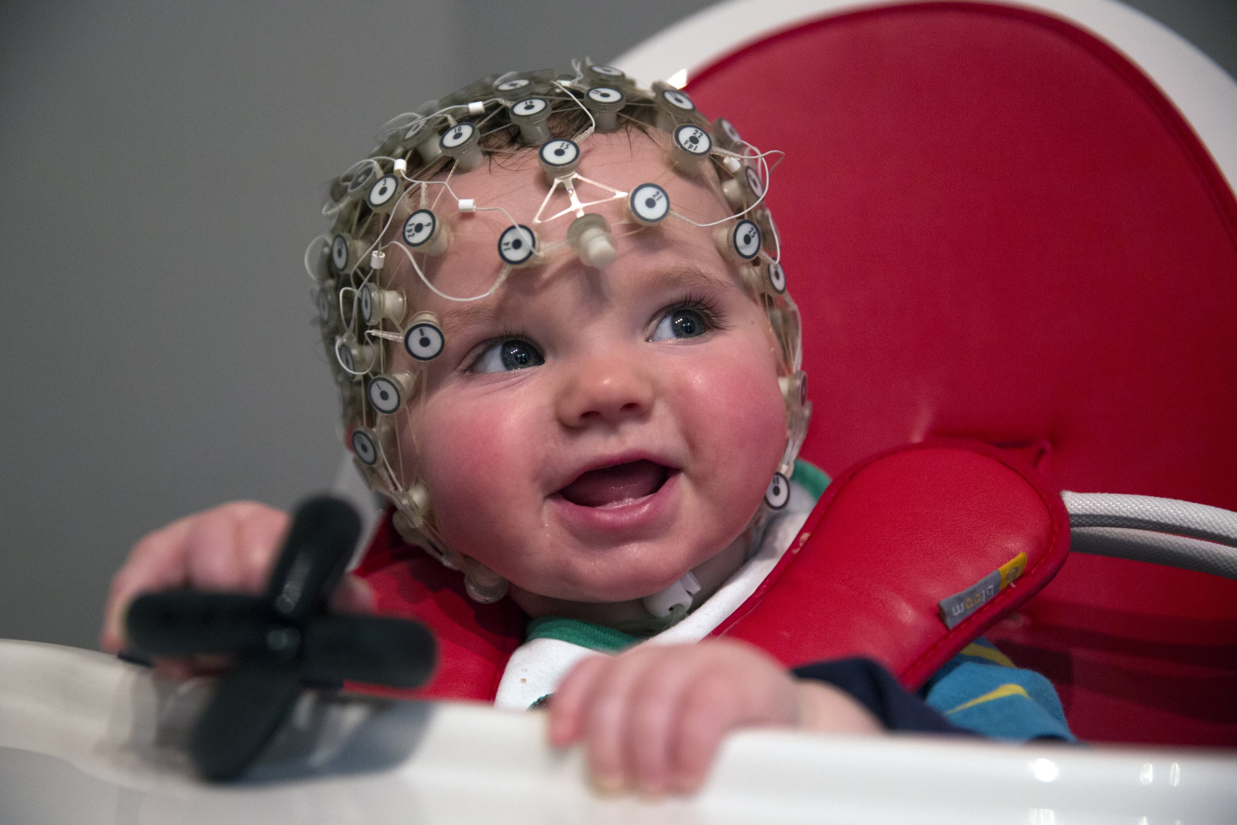 A baby has its brain studied in London