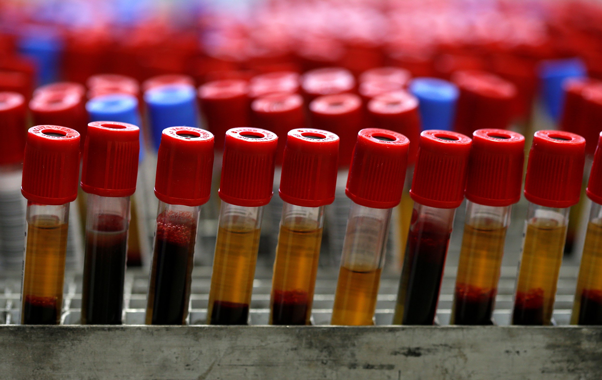 Основные реагенты. Исследование крови красными крышками. Гены крови. Doctor Blood Test. Картина группы крови.