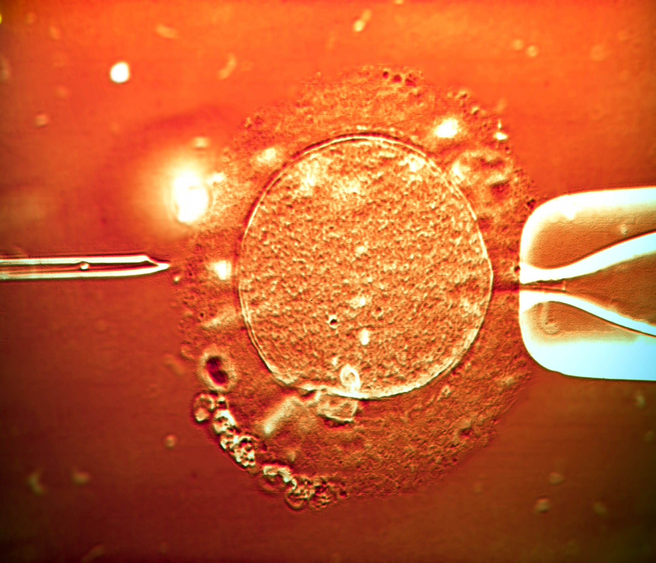 Яйцеклетки сохраняют способность к оплодотворению. Экстракорпоральное оплодотворение ооцитов. Оплодотворение яйцеклетки эко. Яйцеклетка в пробирке. Эко это искусственное оплодотворение.