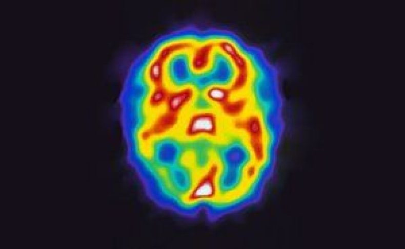 new-ways-of-seeing-the-brain-photos-image3