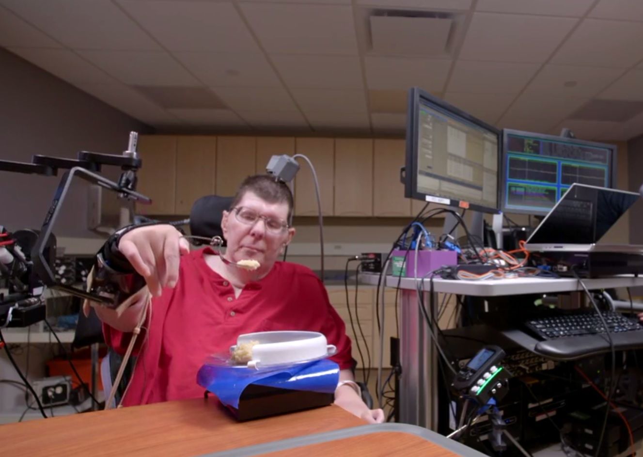 brain implant prosthetic paralused quadriplegic