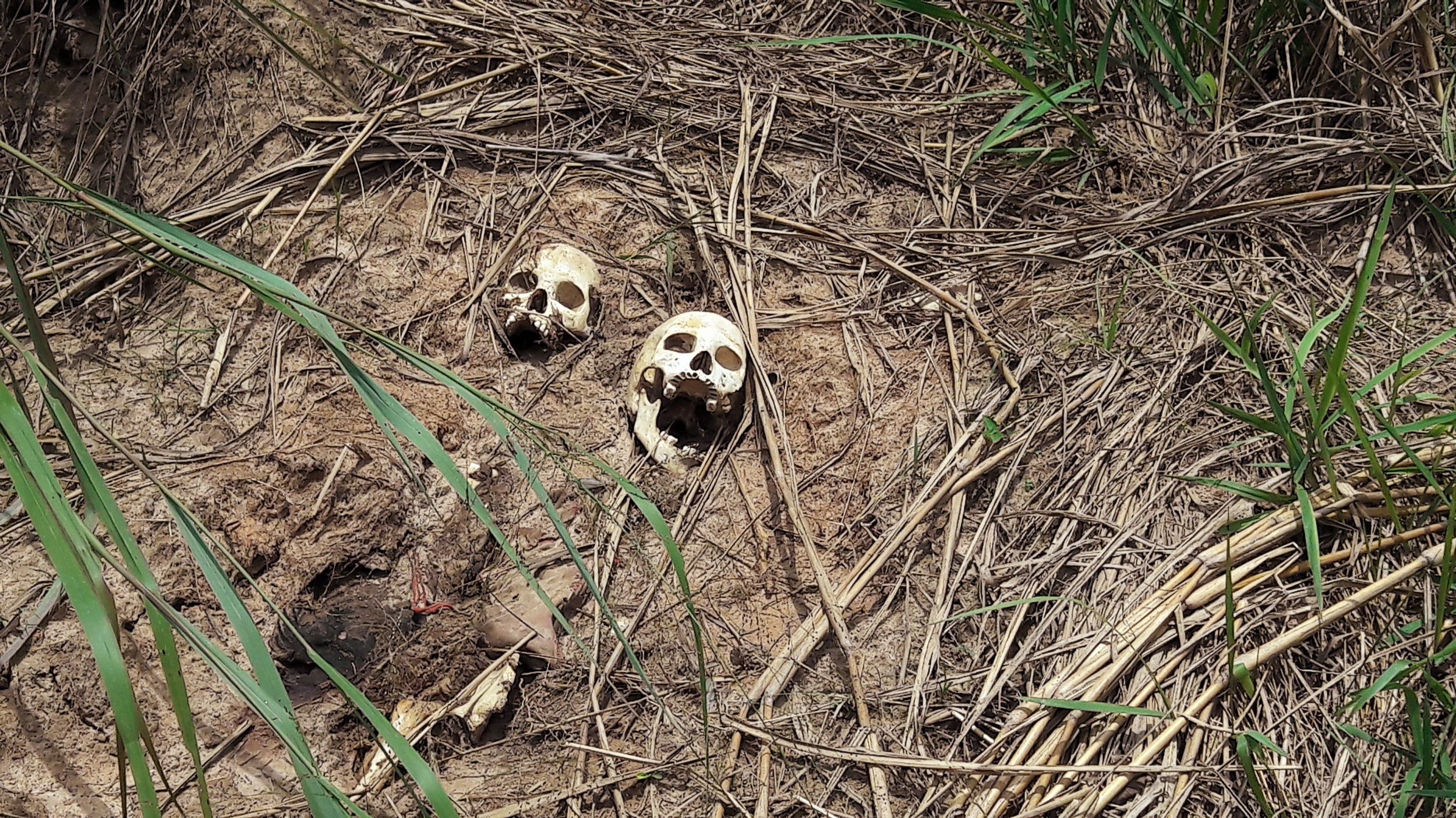 Bones in Congo grave