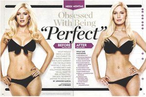 Heidi Montag Why Her Plastic Surgery Disturbs Us