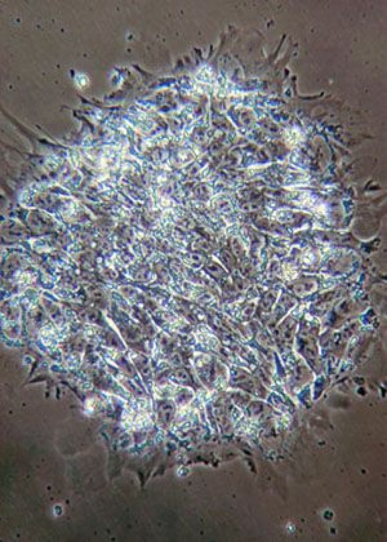 stem-cells-last-slide-330