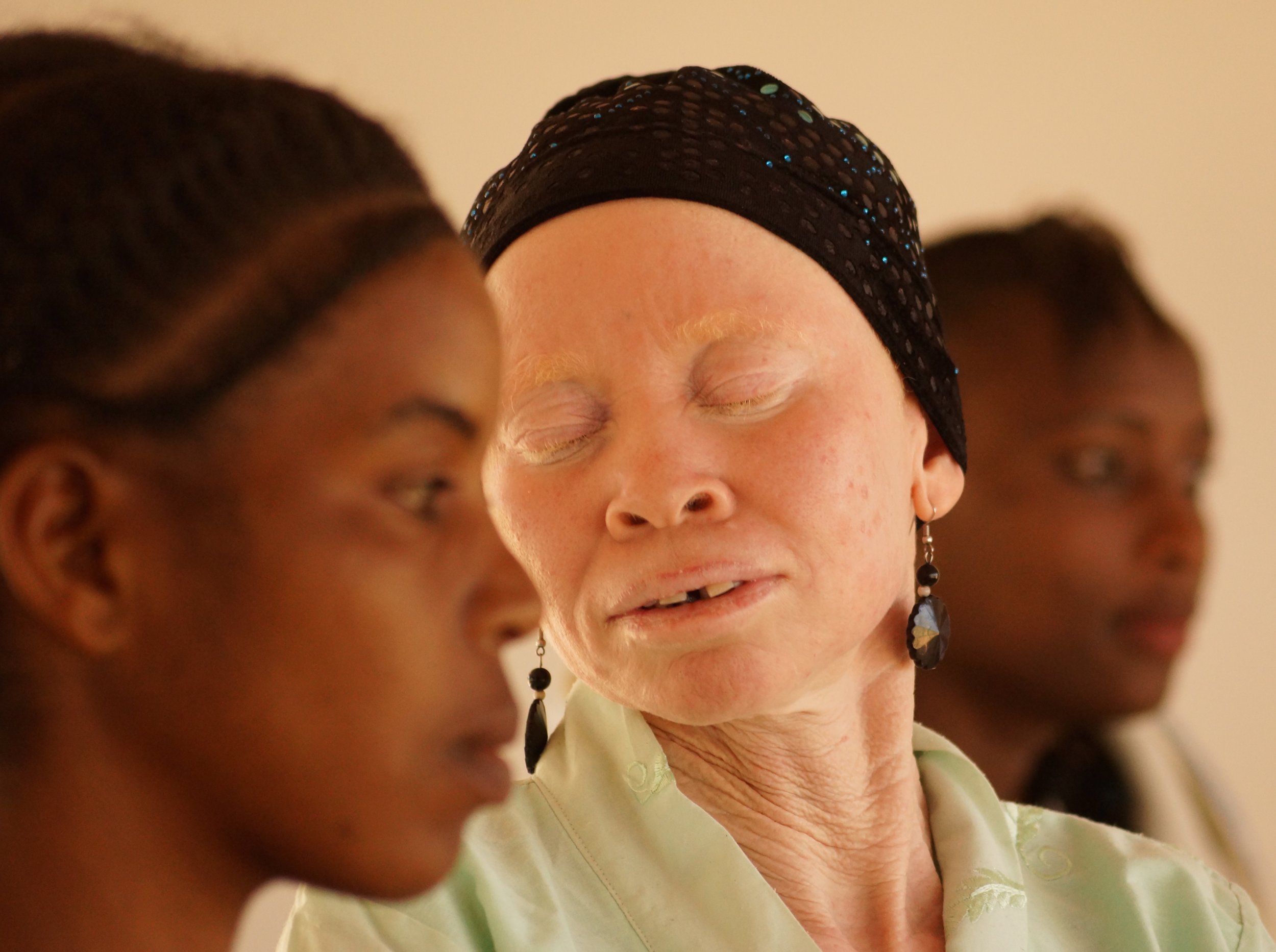 Tanzania albinism collective