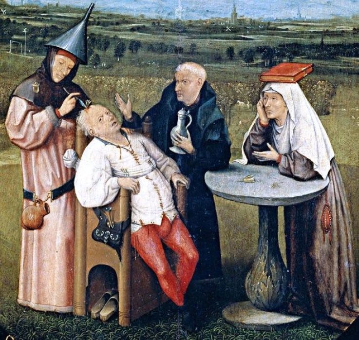 Trepanation Trepanation