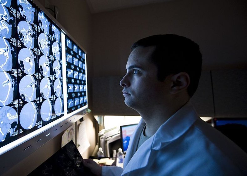 Brain_scan