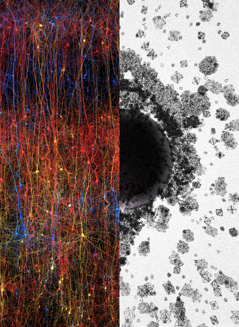 brain multiverse