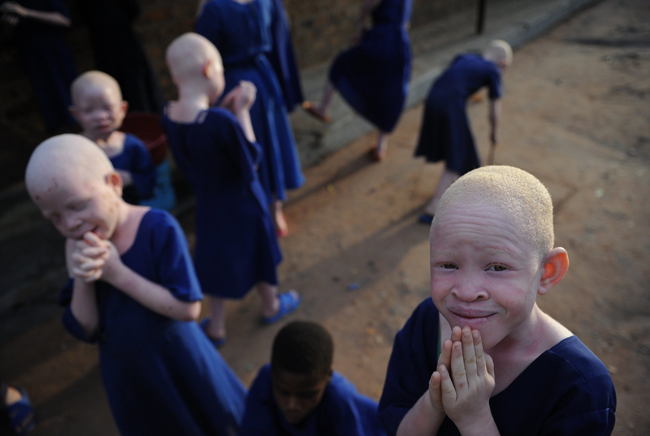 Albino children Tanzania