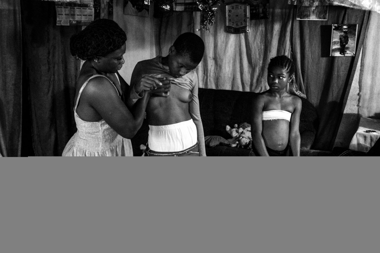 Showing Love Through Breast Ironing: Why Some Daughters Endure This Painful  Practice to Appease Their Mothers