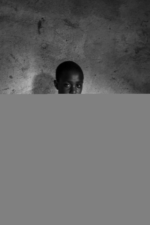 08_11_BreastIroning_09