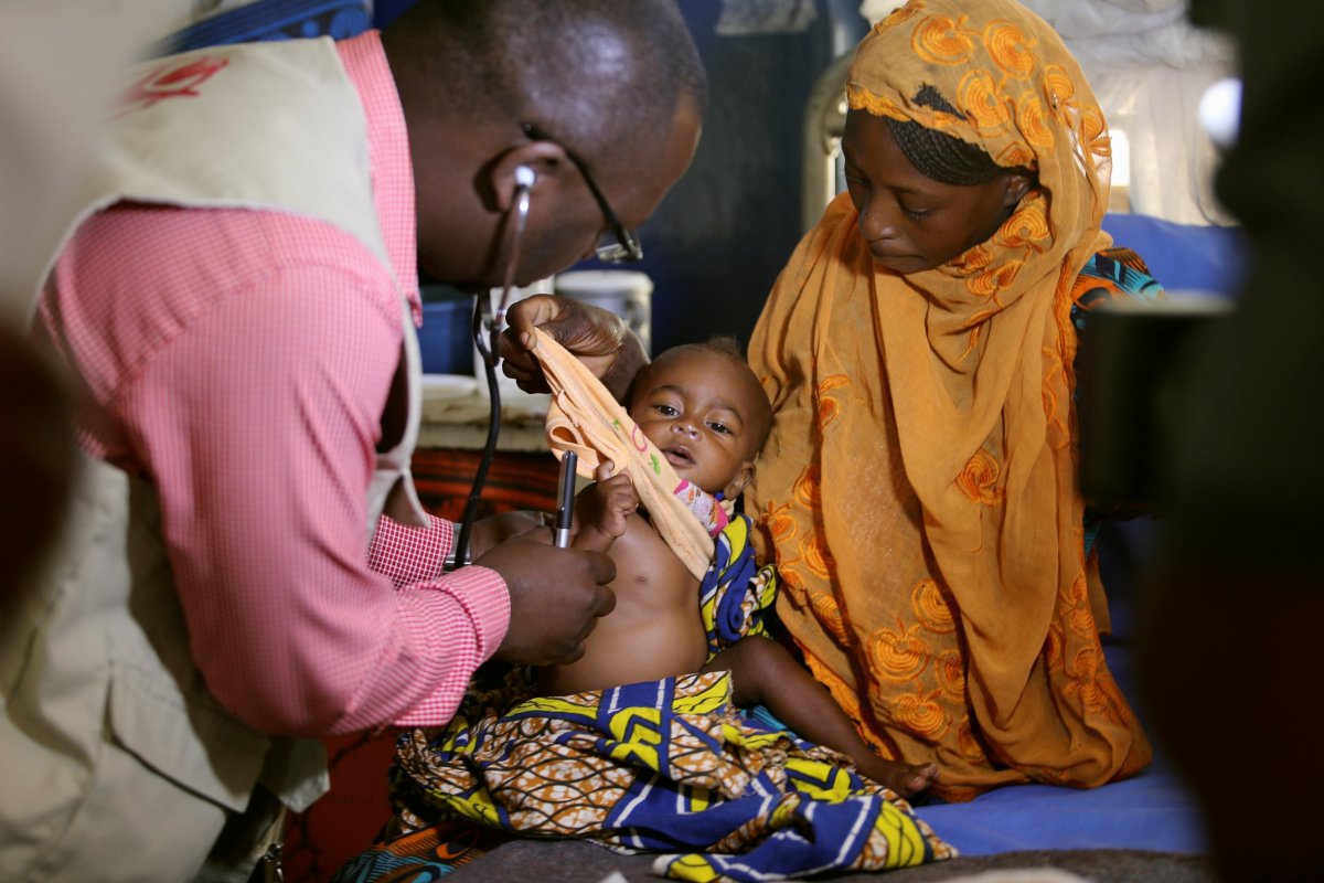 Nigeria malnourished baby