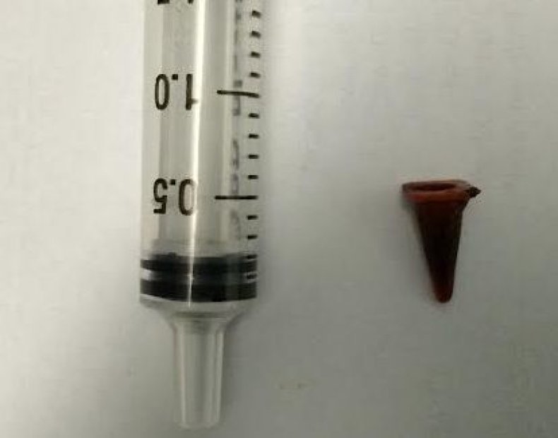 cone