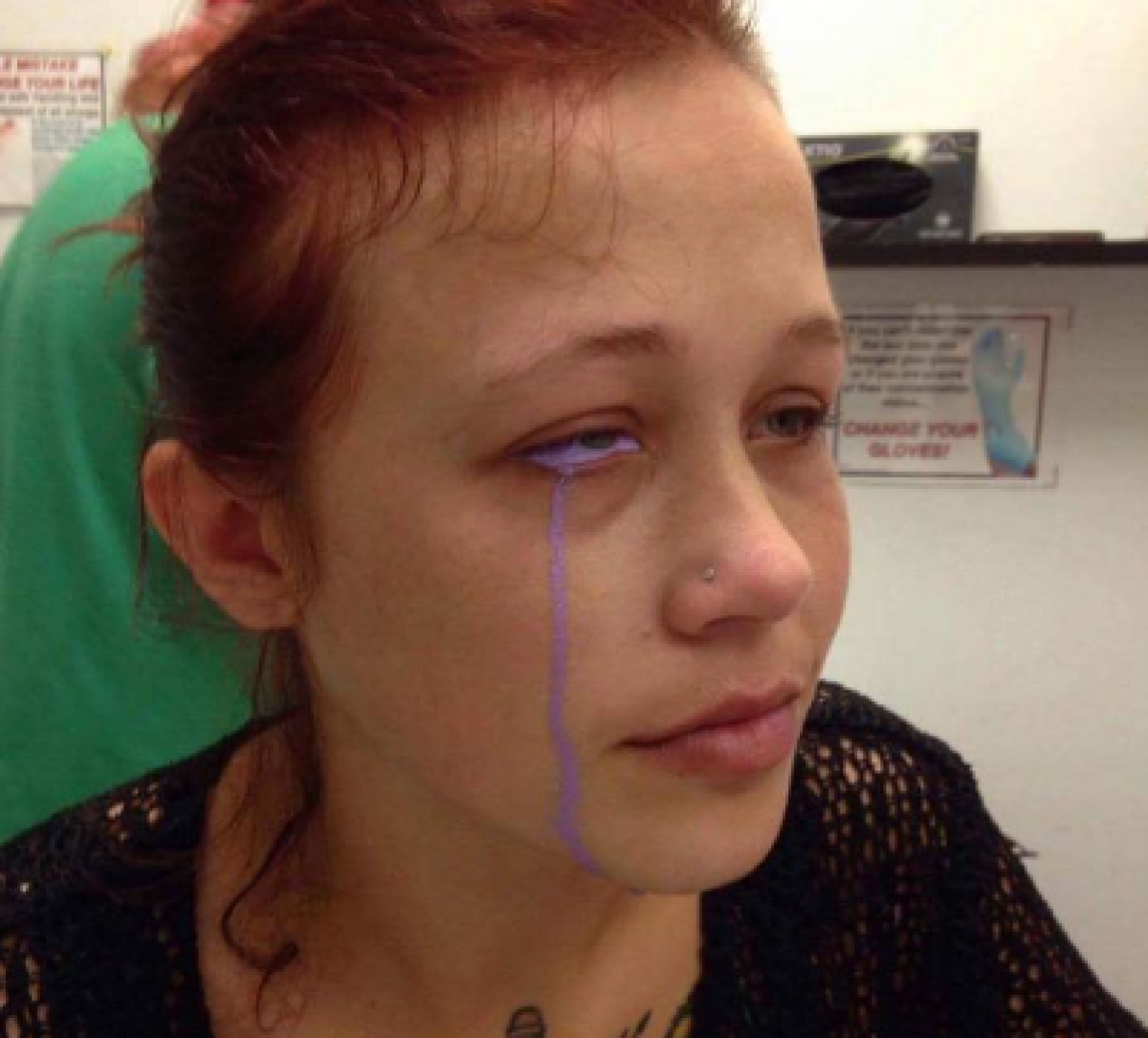Model goes blind after tattooing eyeball, warns others of dangers