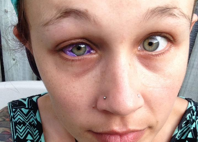 Here's why you shouldn't offer under eye tattooing to clients yet