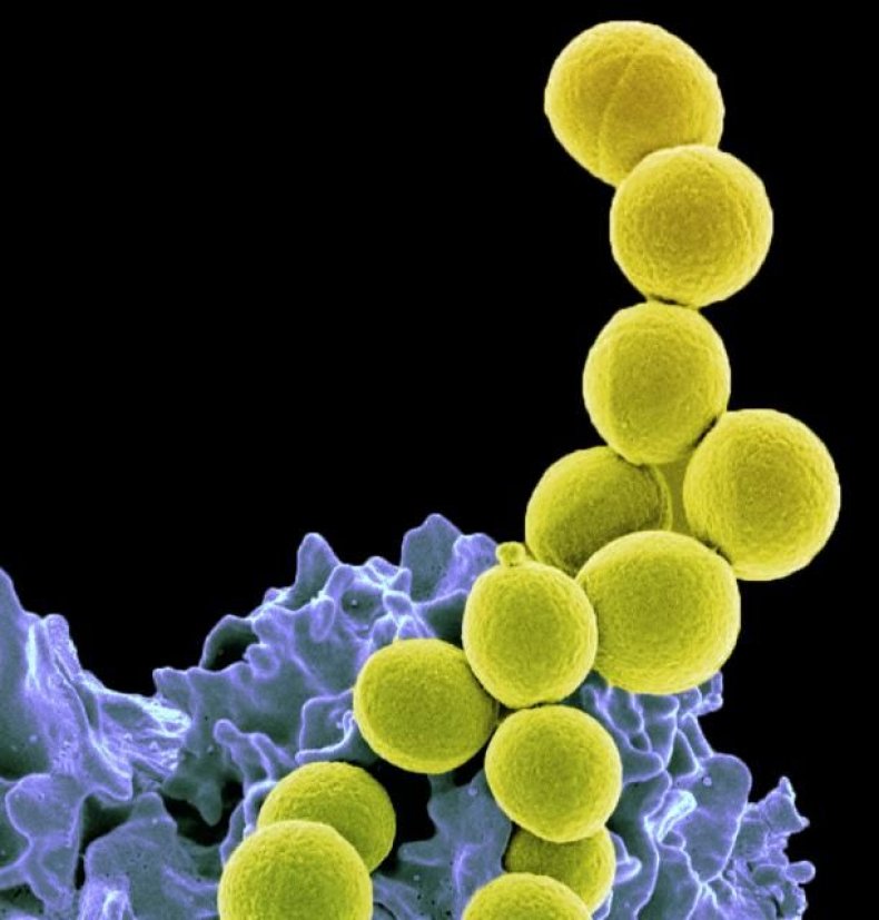 MRSA bacteria