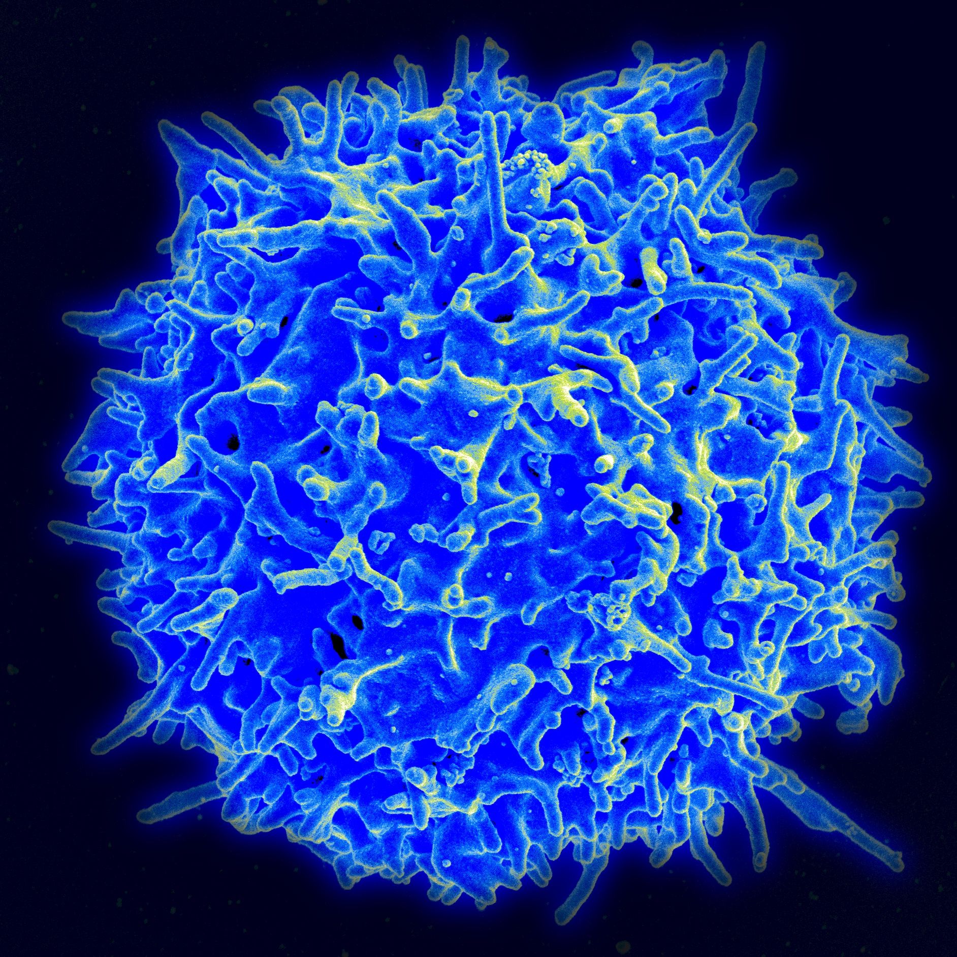 Healthy T cell lymphocyte