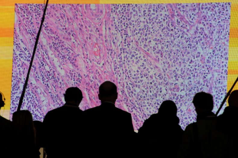 Cancer immunotherapy 1