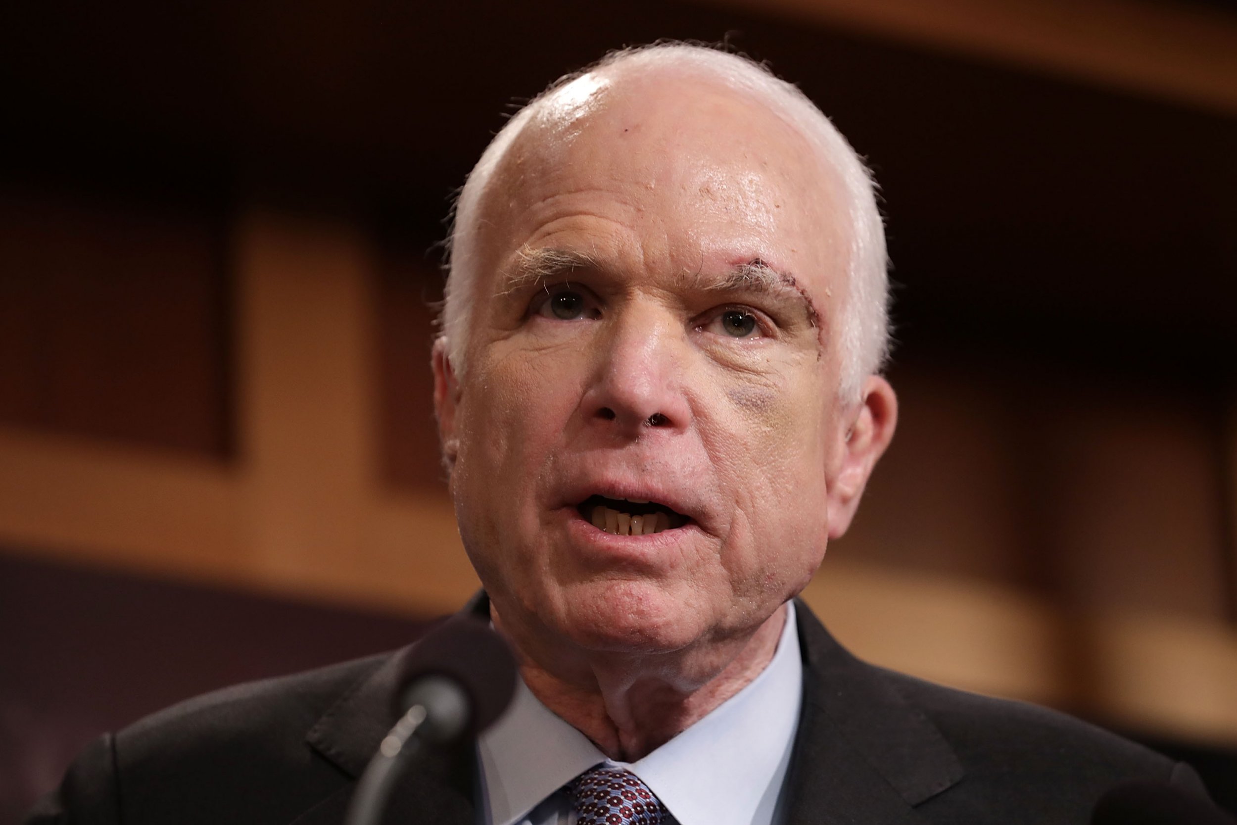 McCain Brain Tumor Scar