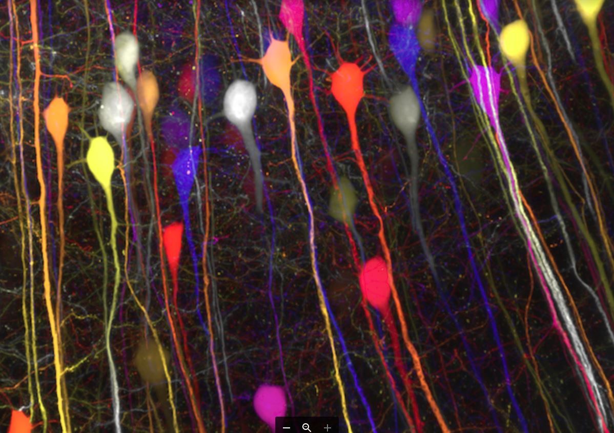 laser brain microscope alzheimers nerve