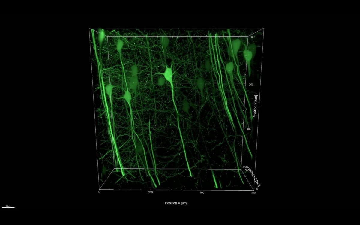 laser microscope neuron firing brain