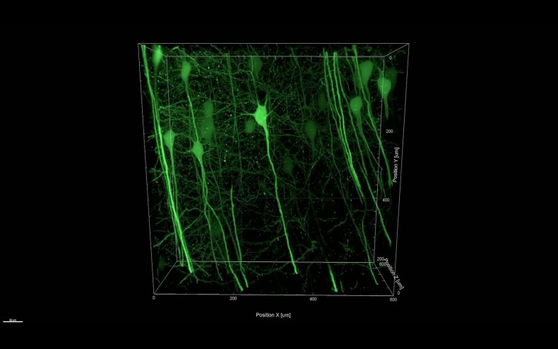 laser microscope neuron firing brain