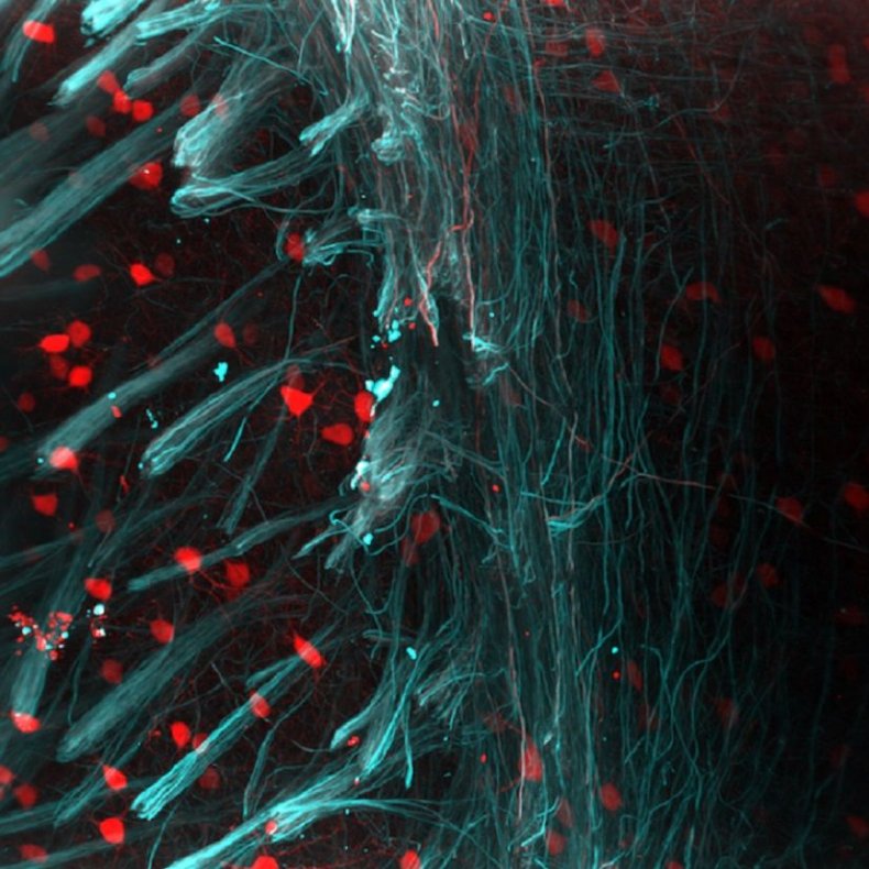 neurons brain images lasers