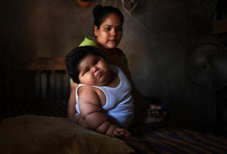 Baby From Mexico Weighs As Much As A Nine Year Old And Doctors Can T Figure Out Why Baby From Mexico Weighs As Much As A Nine Year Old And Doctors Can T Figure Out Why