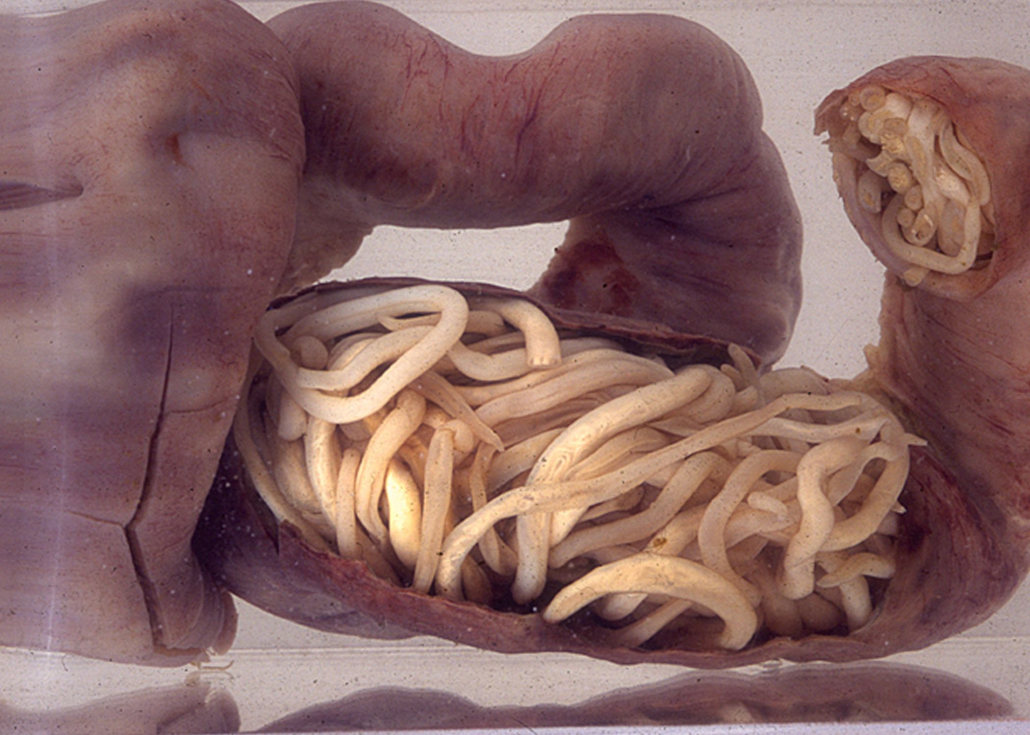 roundworms eggs in humans