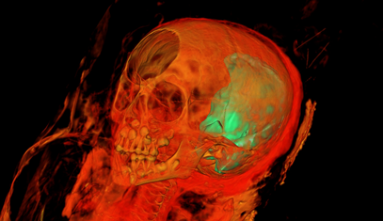 MummySkull