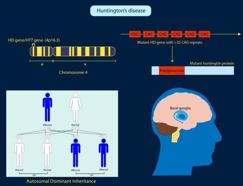 Breakthrough Huntington's Disease Drug Hits Devastating Brain Condition