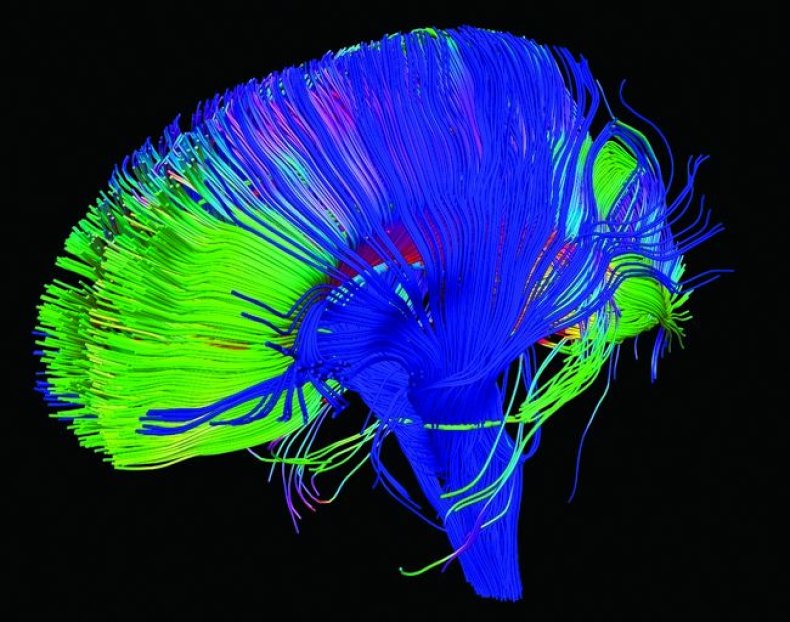 12_13_Diffusion Tensor Brain
