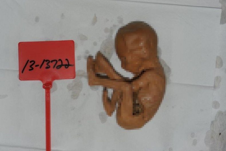 12_26_fetus_02