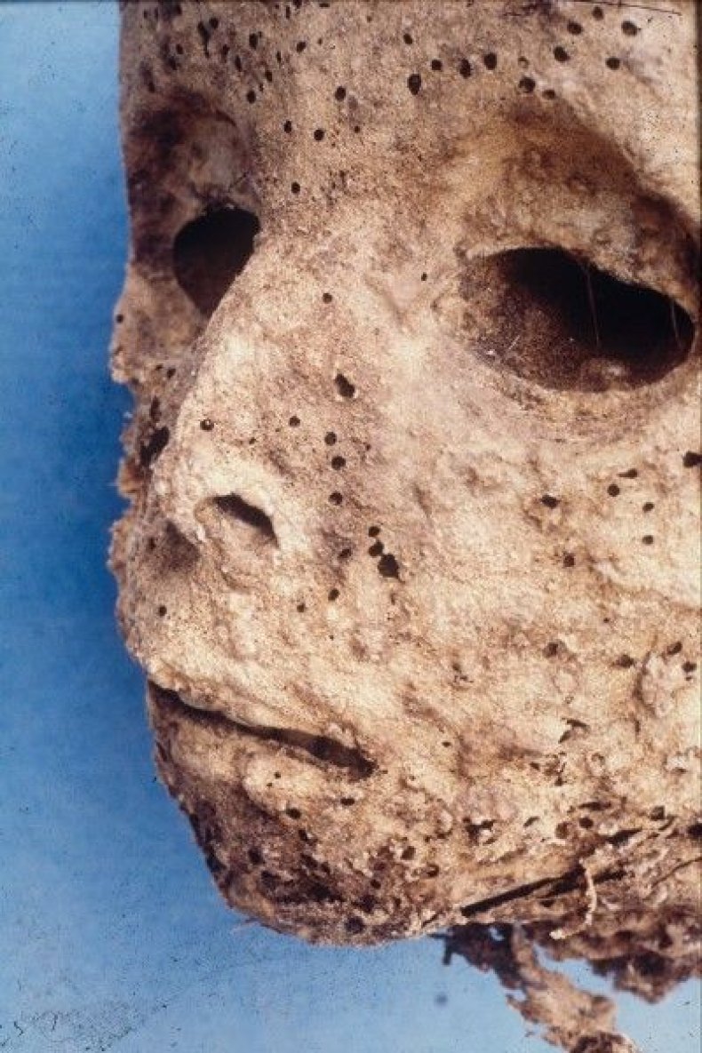 mummyface