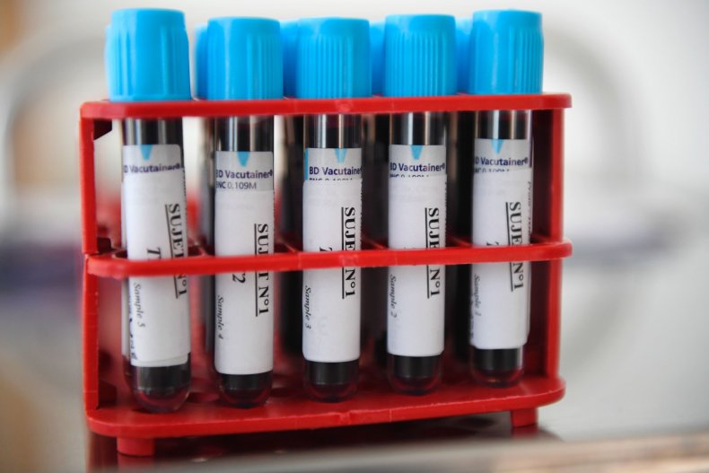 Biotrial blood samples