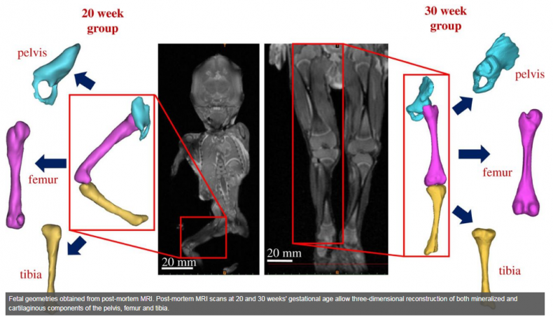 bones1