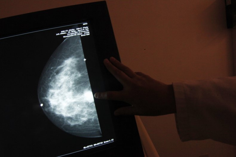 breast cancer mexico scan