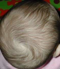 hair-whorl-crpd hair-whorl-crpd