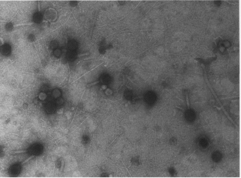 2_7_Virus