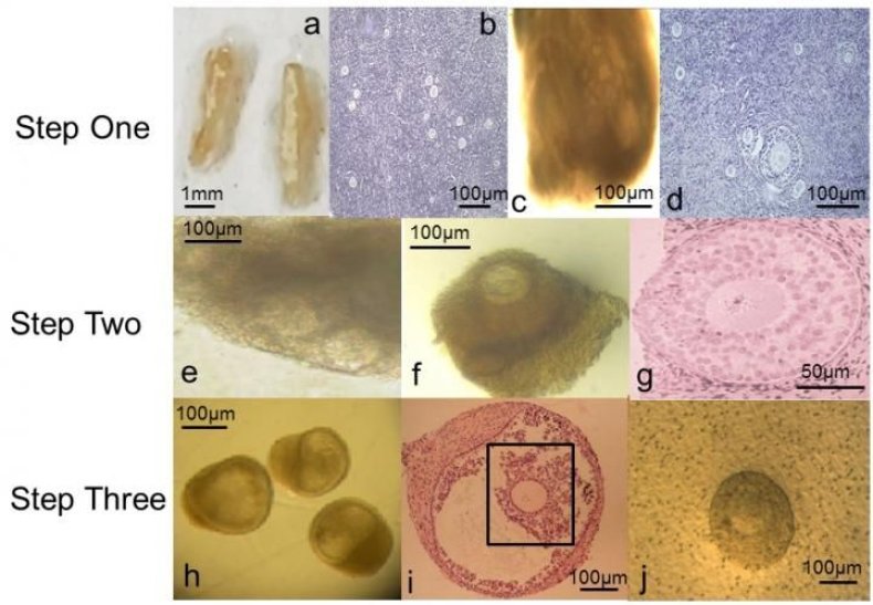 2_9_Human Eggs development
