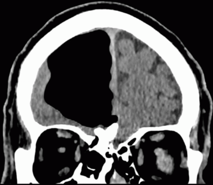 3_11_BMJ MRI 3_11_BMJ MRI