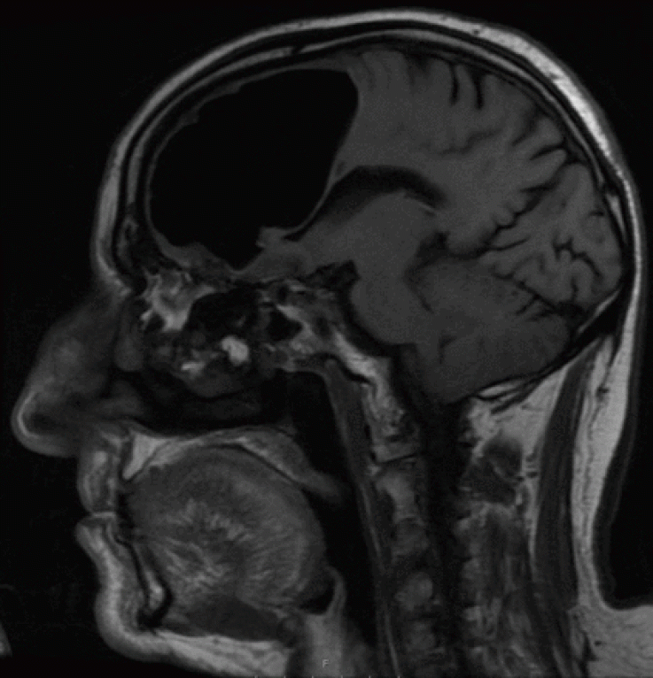 3_11_BMJ MRI Scan 3_11_BMJ MRI Scan