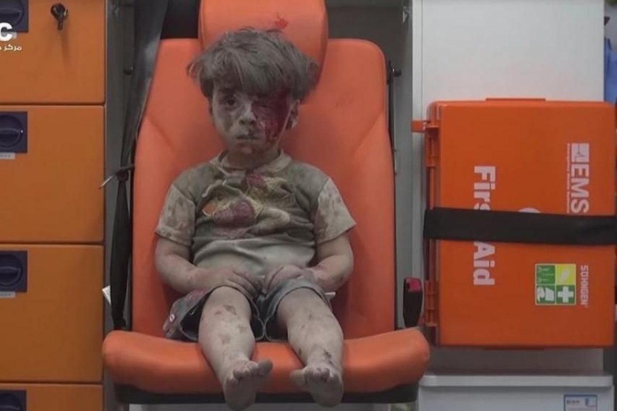syria-boy-after-aleppo-air-strike