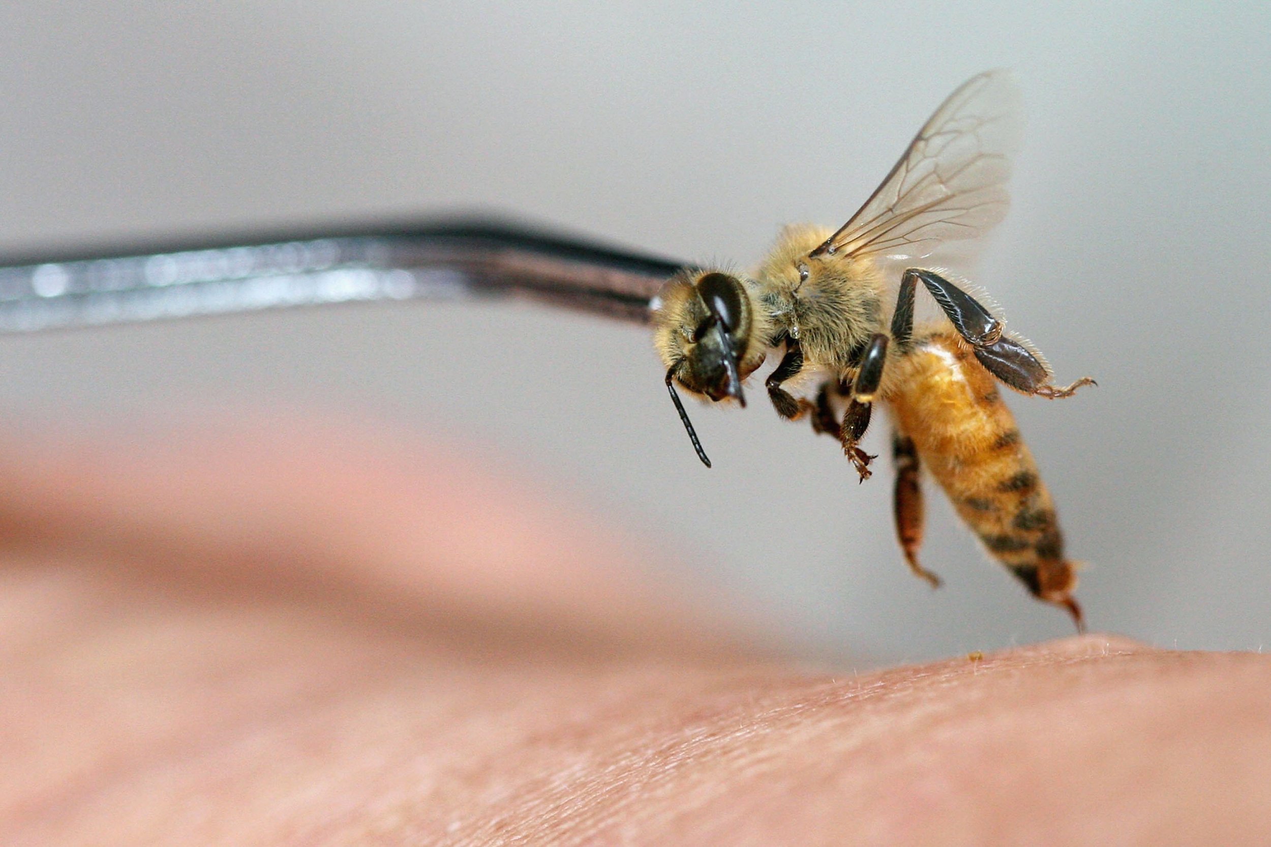 why-do-bee-stings-hurt-the-roles-of-the-stinger-and-the-bee-venom