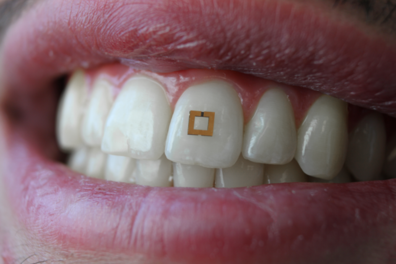 3_25_sensor on tooth