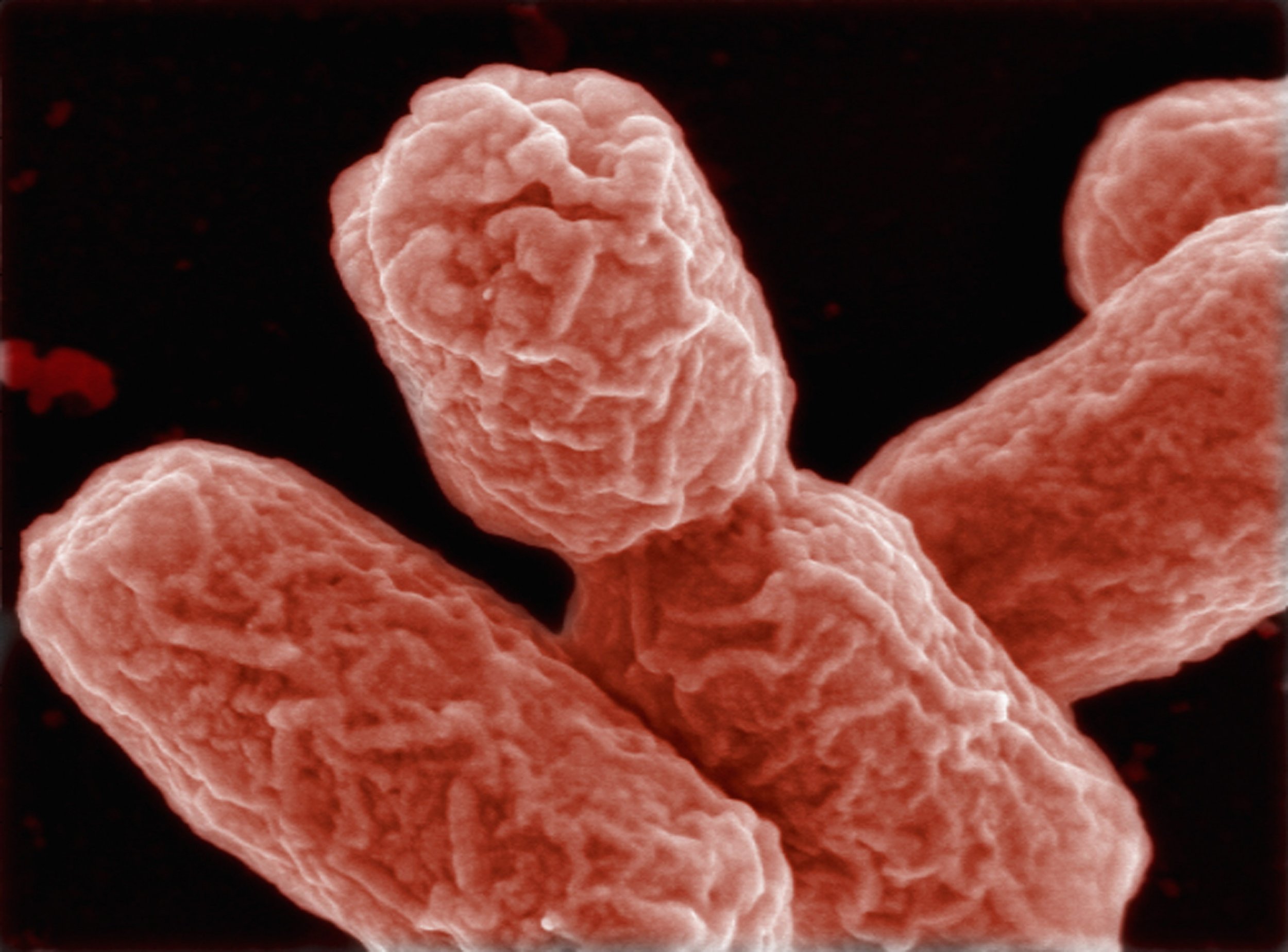 E. Coli Outbreak Spreads to Seven States Without Known Cause CDC