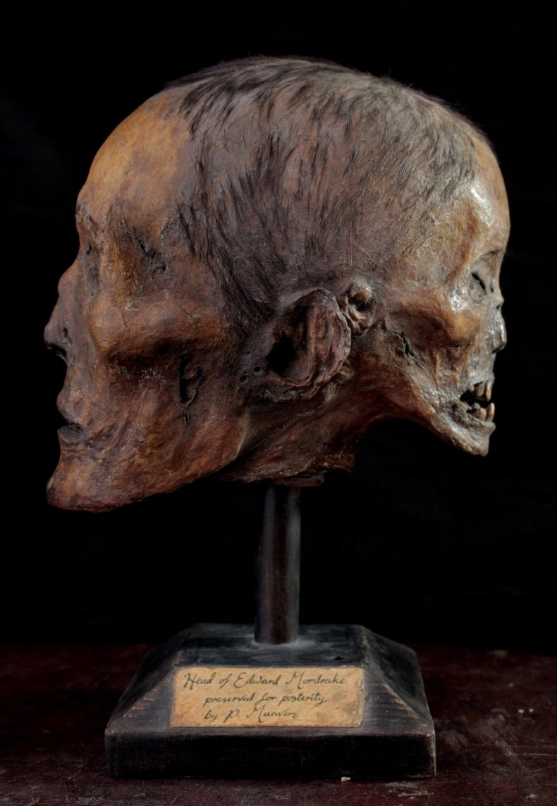 Edward Mordrake's head