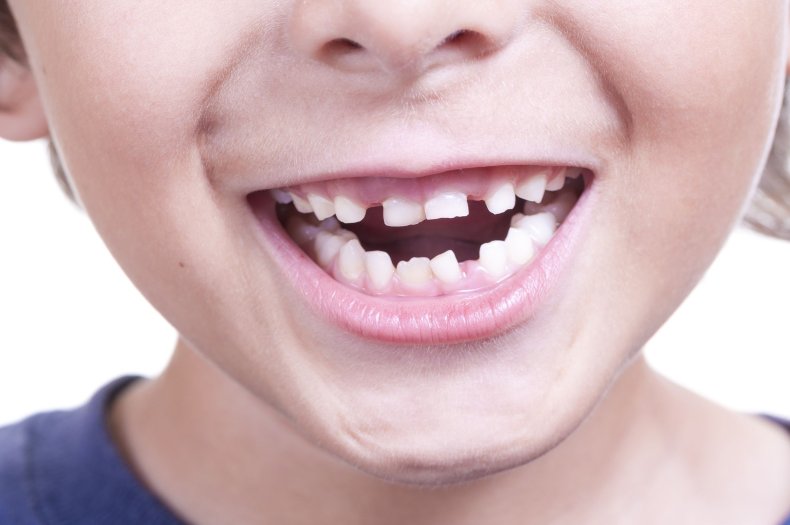 teeth-children-stock