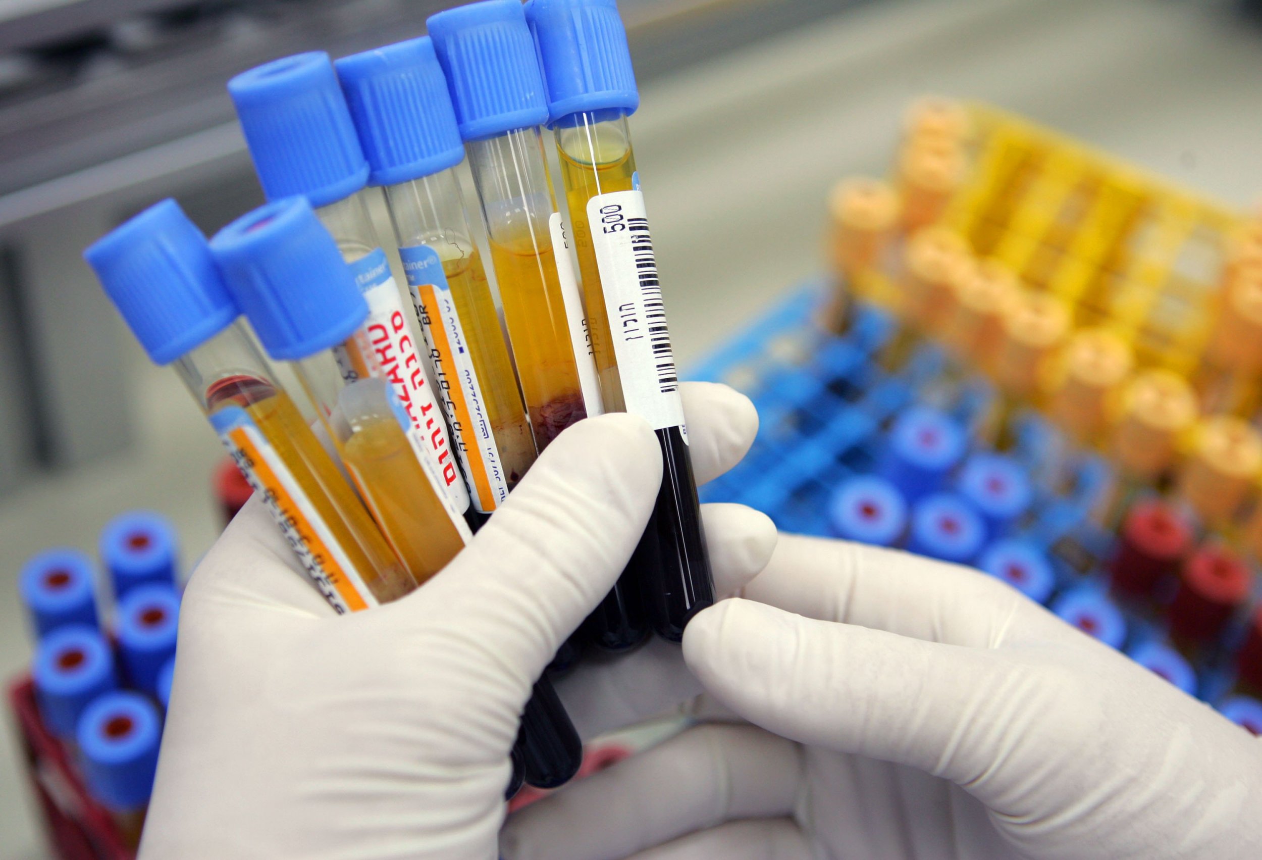 What Are The 5 Types Of Blood Tests