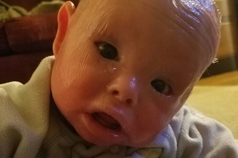 Mother Forced to Bathe Baby in Bleach to Help Battle Rare ...